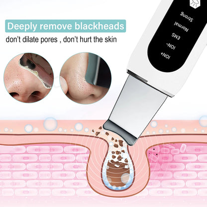 Cosmolab™ GlowUp Ultrasonic Skin Scrubber