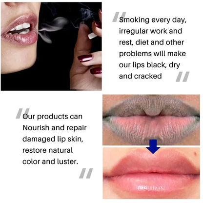 Remove Dark Lip Balm