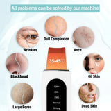 Cosmolab™ GlowUp Ultrasonic Skin Scrubber